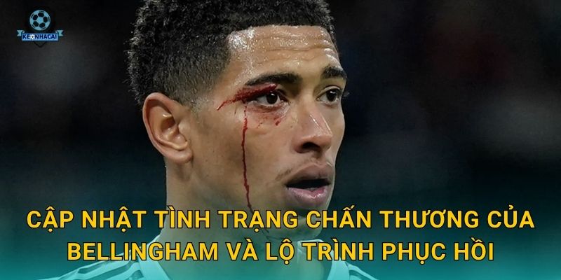 Bellingham chấn thương bao lâu – Tin tức y tế mới nhất và tác động đến kèo Real từ Kèo nhà cái 1 Cập nhật tình trạng chấn thương của Bellingham và lộ trình phục hồi